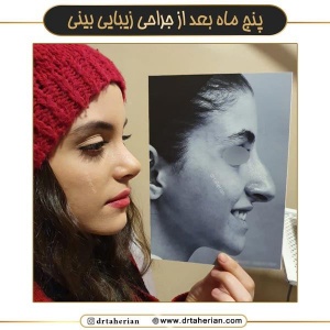 جراحی-بینی-719