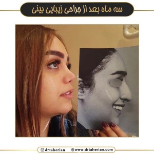 جراحی-بینی-722