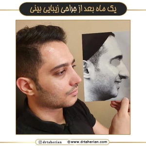 جراحی-بینی-726