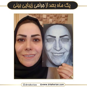 جراحی-بینی-727