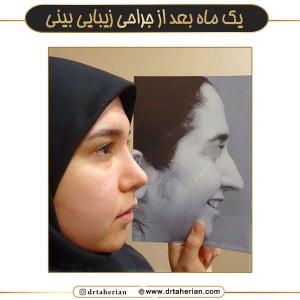 جراحی-بینی-729