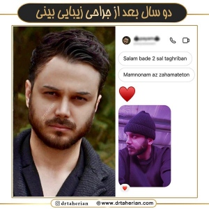 جراحی-بینی-731