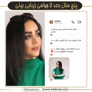 جراحی-بینی-732