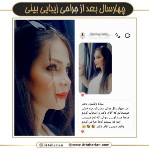 جراحی-بینی-737