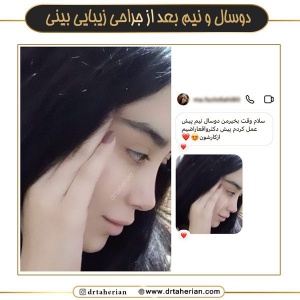 جراحی-بینی-738