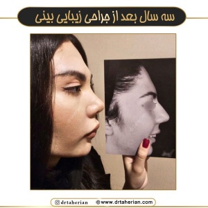 جراحی-بینی-743