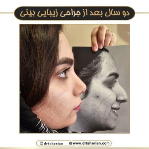 جراحی-بینی-749