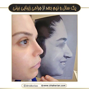 جراحی-بینی-750