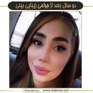 جراحی-بینی-753