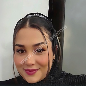 rhinoplasty-886