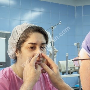 rhinoplasty-887