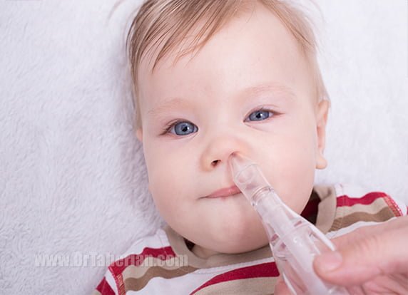 شاخک های بینی