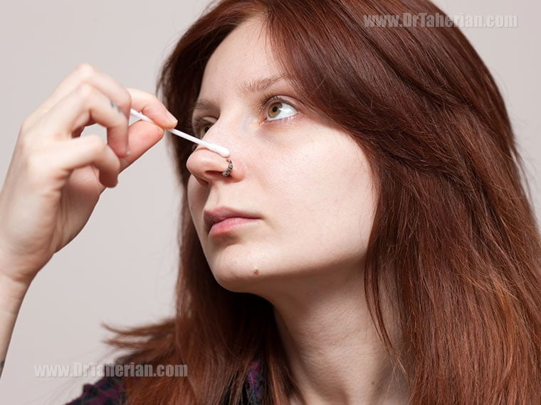 مراقبت های بعد از پیرسینگ