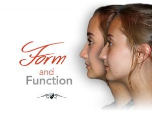 septoplasty vs rhinoplasty