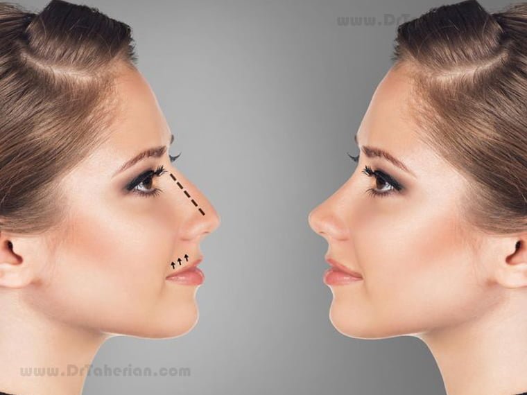 How to choose nose shape?