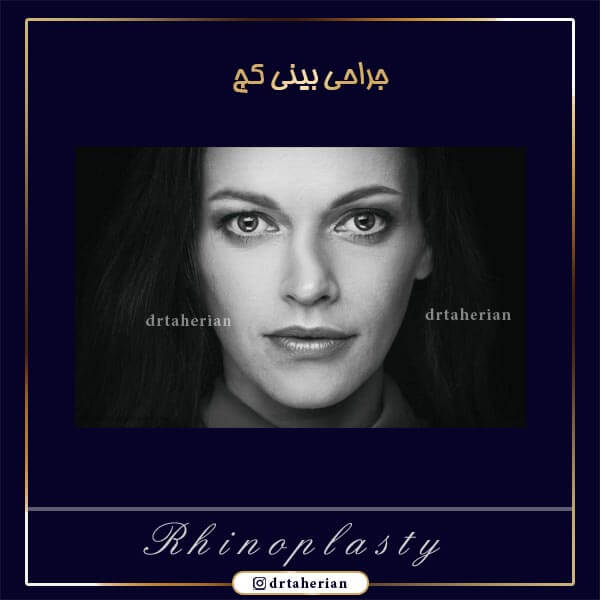 جراحی بینی کج توسط بهترین حراح بینی تهران