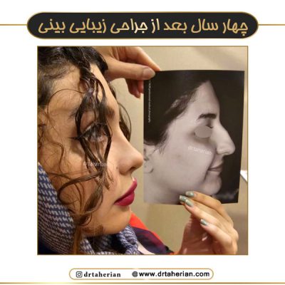 جراحی بینی فانتزی در تهران - دکتر طاهریان