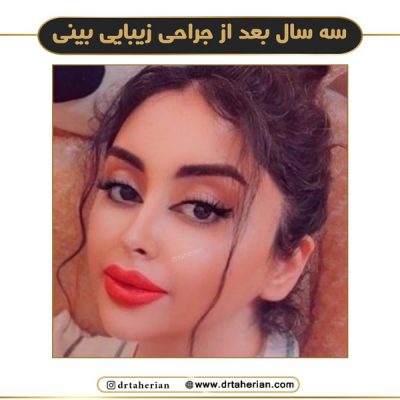 جراحی بینی فانتزی در تهران - دکتر طاهریان