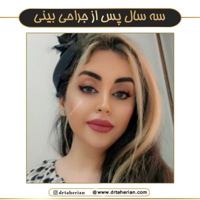 جراحی بینی فانتزی در تهران - دکتر طاهریان