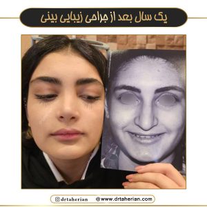 جراحی بینی در تهران - دکتر طاهریان