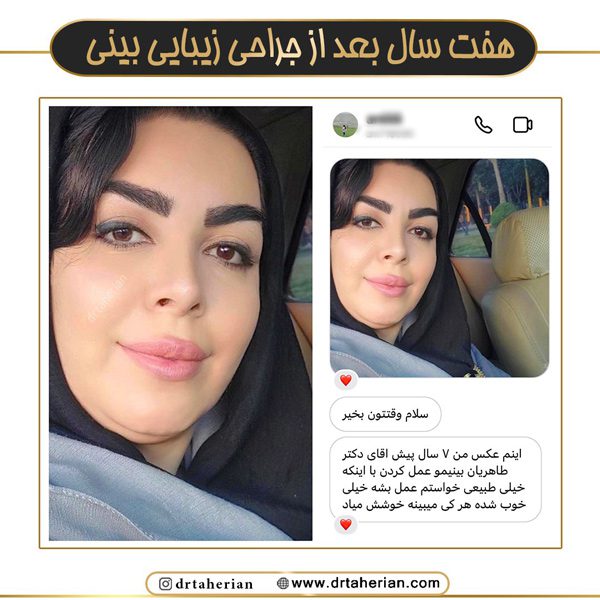 جراحی بینی در تهران - دکتر طاهریان