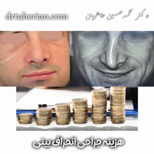 جراحی انحراف بینی