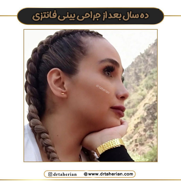 جراحی بینی دکتر طاهریان در تهران