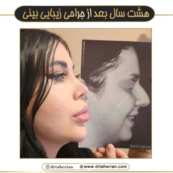 جراحی بینی دکتر طاهریان