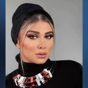 نمونه جراحی بینی دکتر محمدحسین طاهریان در تهران