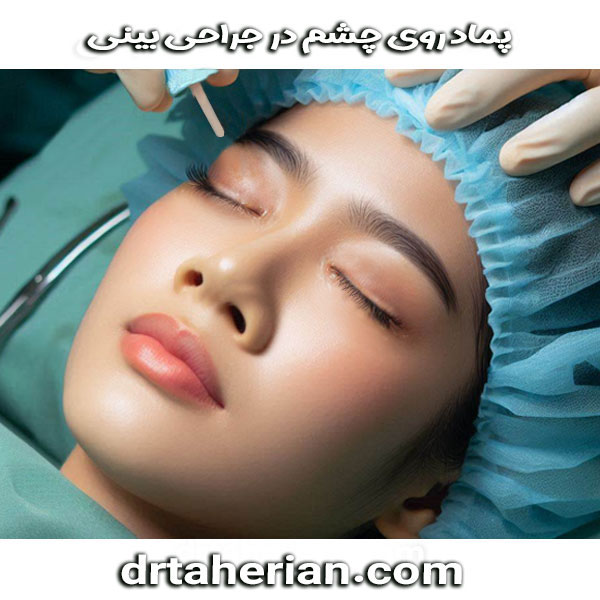پماد روی چشم در جراحی بینی از دکتر محمدحسین طاهریان ، بهترین جراح بینی تهران