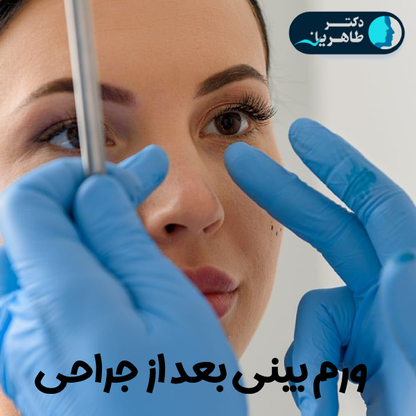 عکس ورم بینی بعد از عمل - دکتر محمدحسین طاهریان